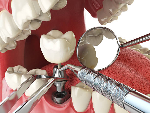 Best Emergency Orthodontic Repairs in Byrdstown, TN